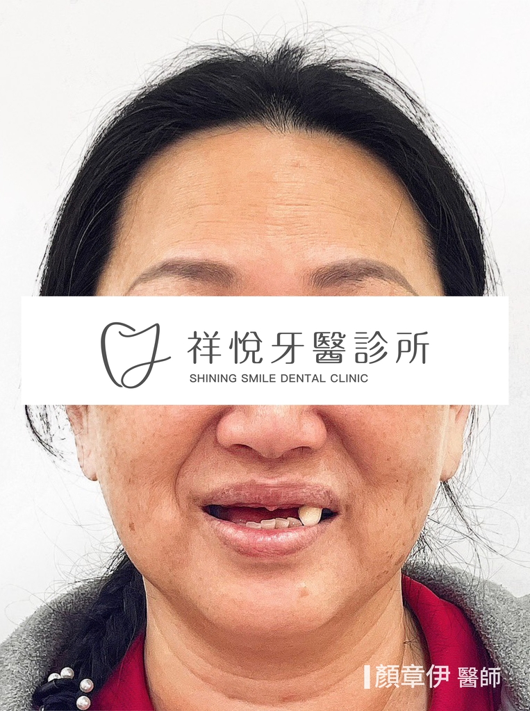 一日長城治療前