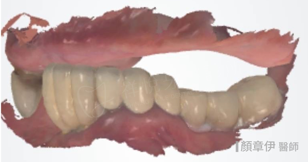 一日長城治療後