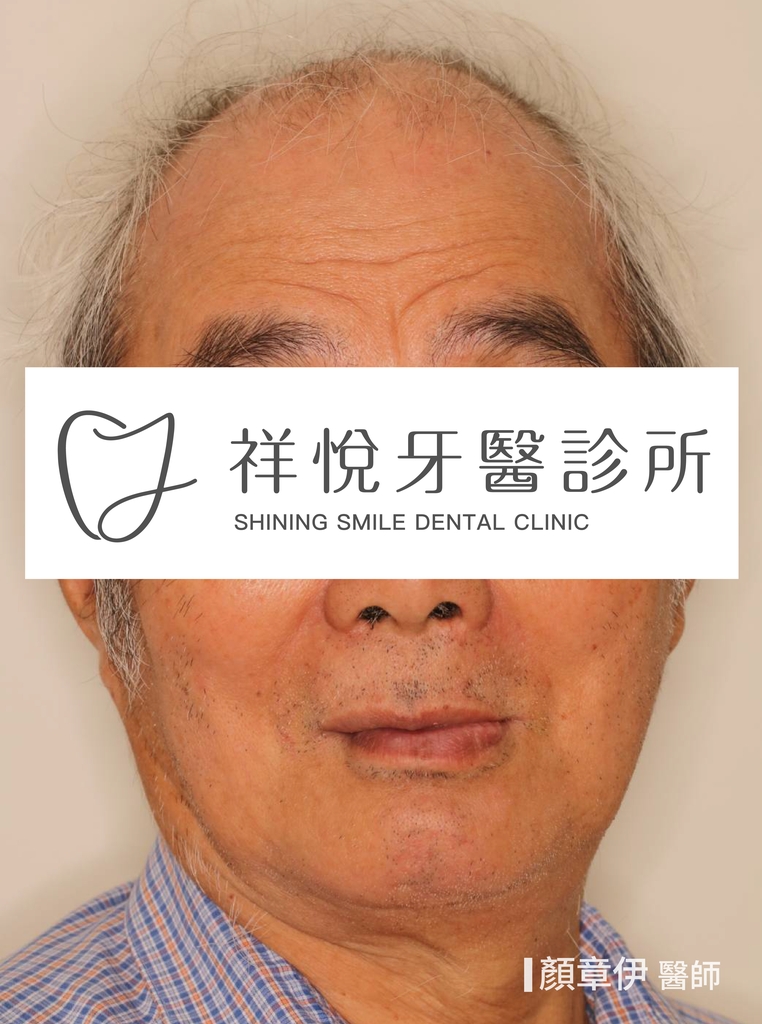 一日長城治療前