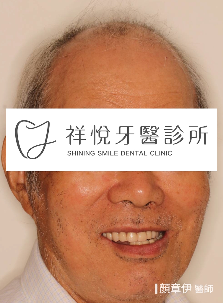 一日長城治療後