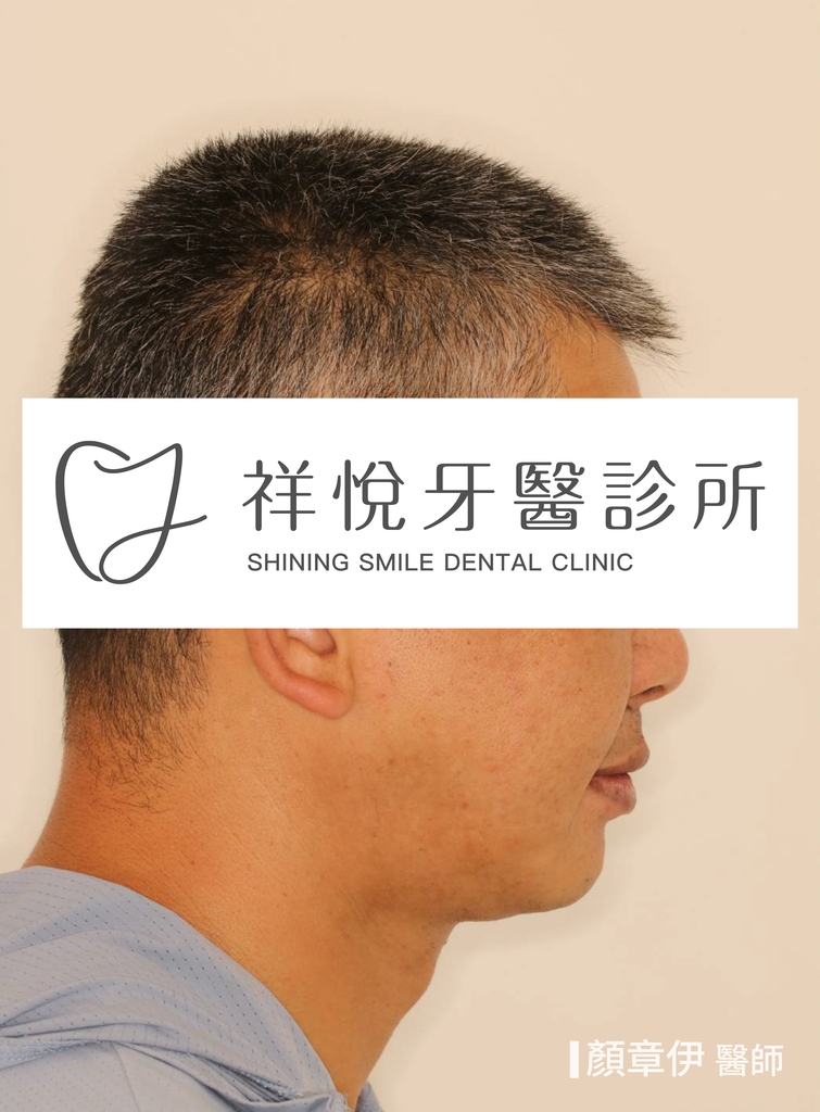 一日長城治療後