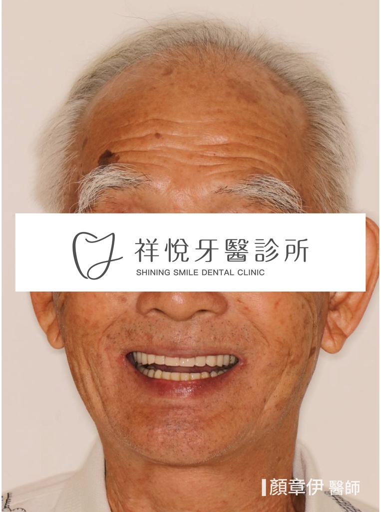 一日長城治療後