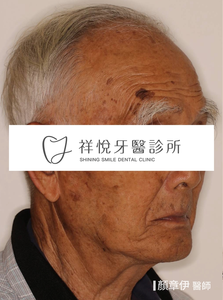 一日長城治療前