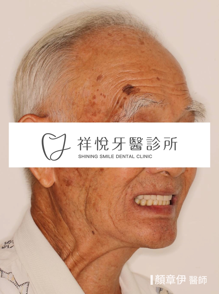 一日長城治療後