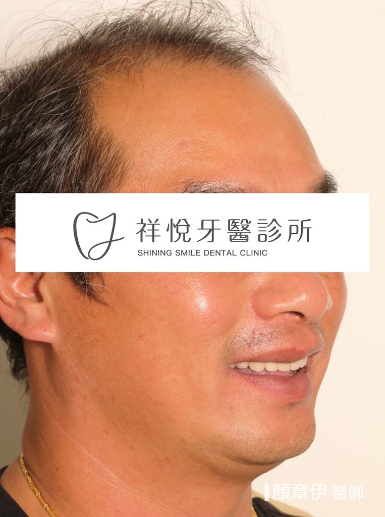 一日長城治療後