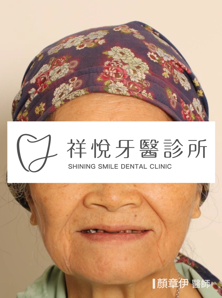 一日長城治療前