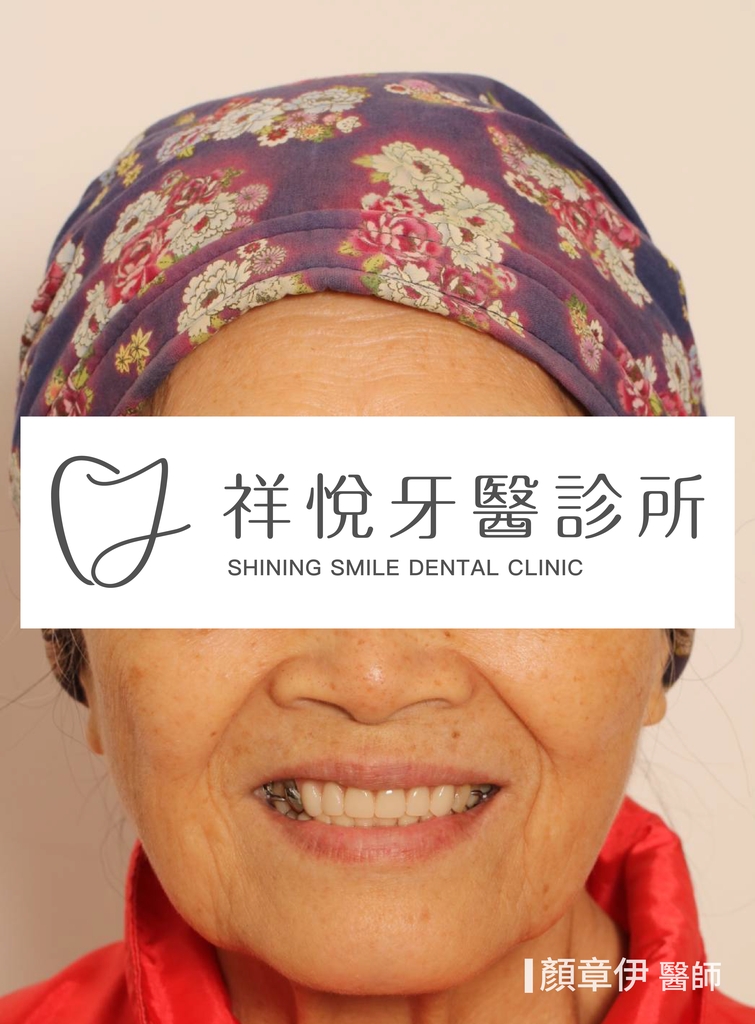 一日長城治療後