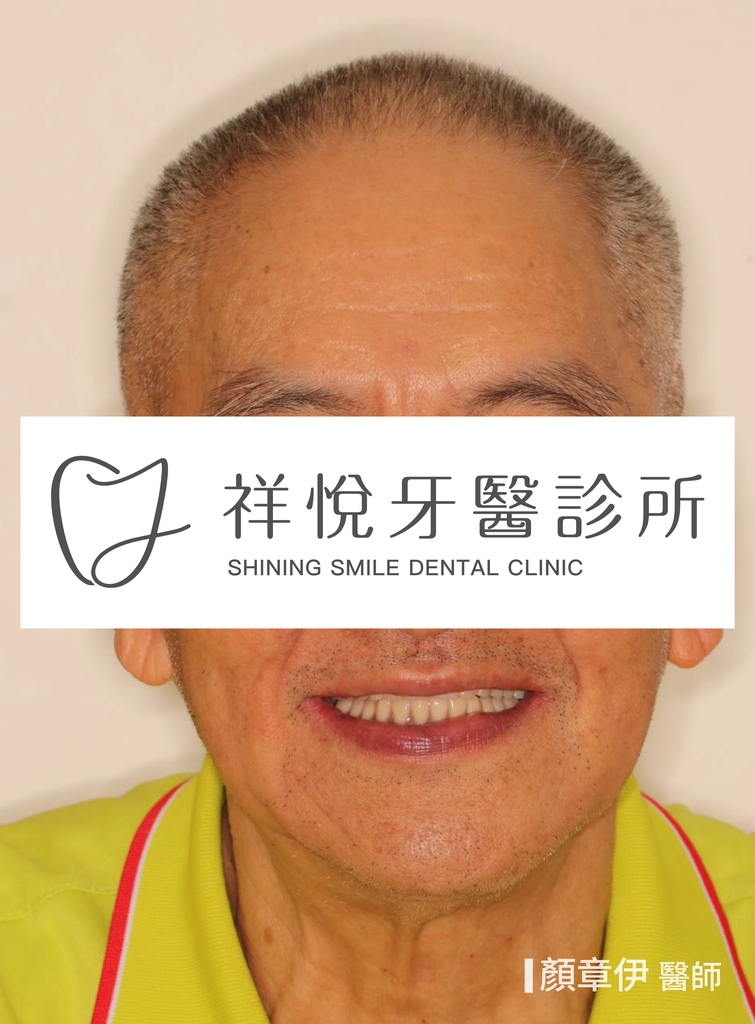 一日長城治療後