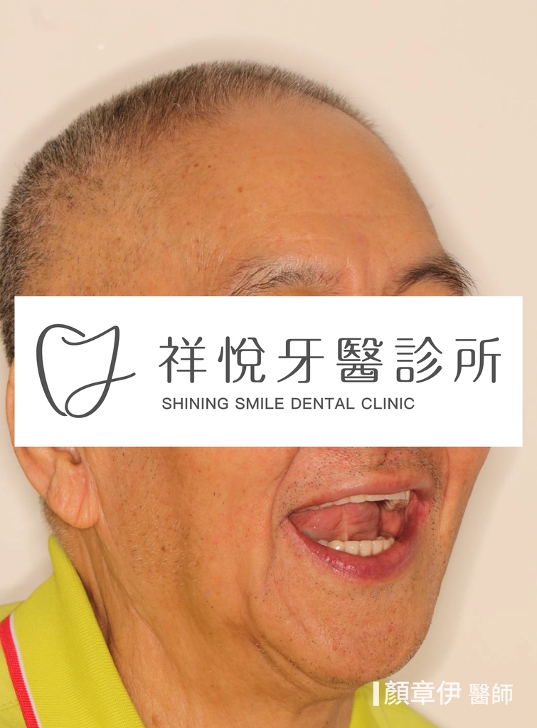 一日長城治療後