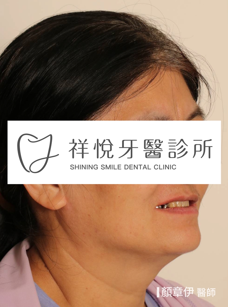 一日長城治療前