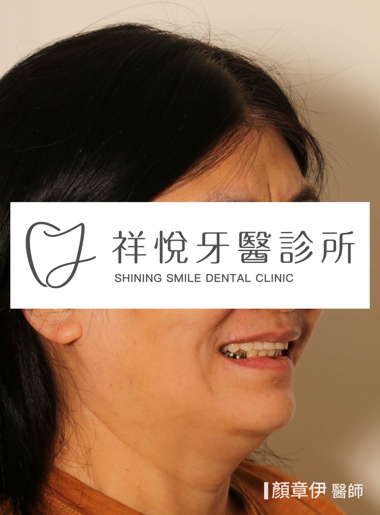 一日長城治療後