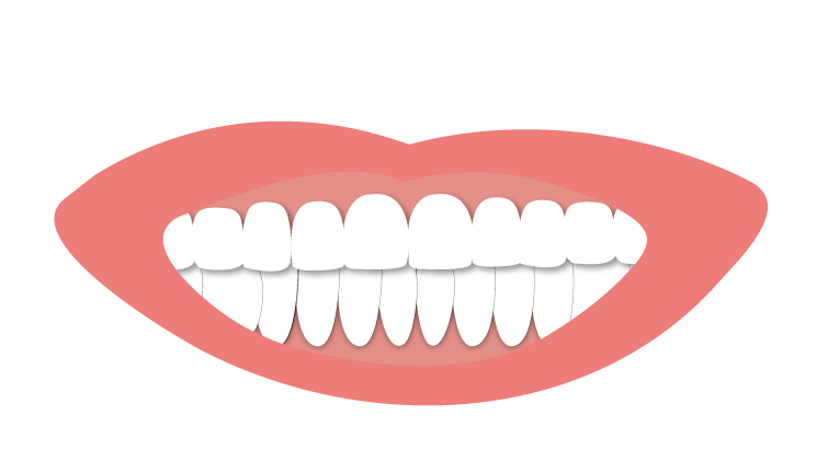 當天手術當天有牙