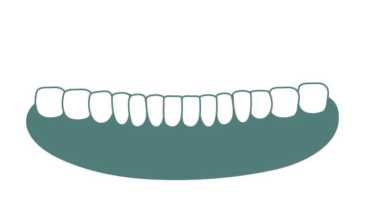 當日安裝正式假牙