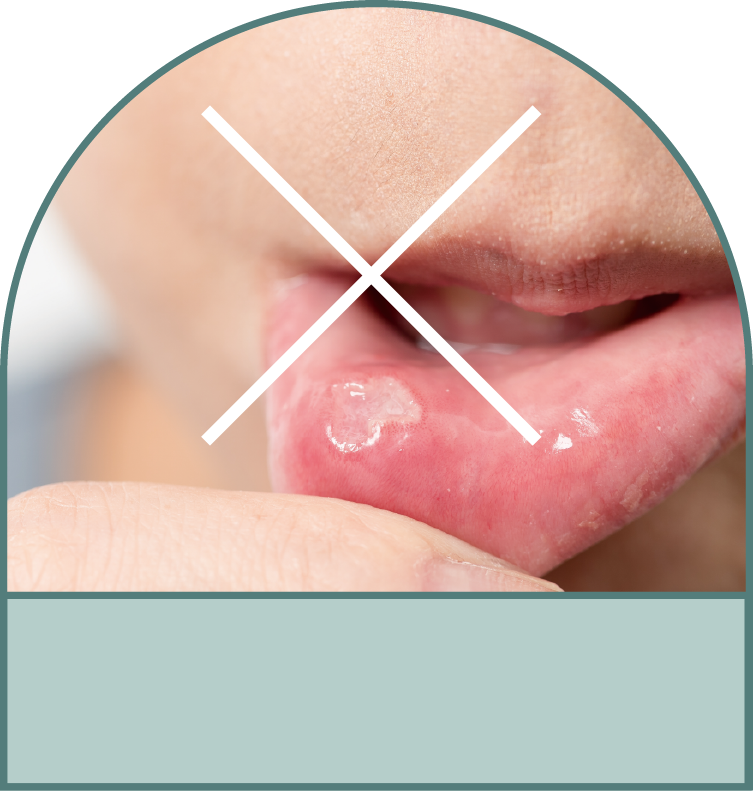 無刮嘴磨破口腔的困擾