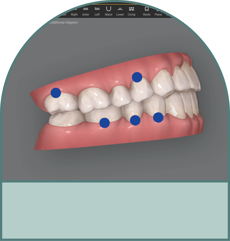 預測未來矯正結果