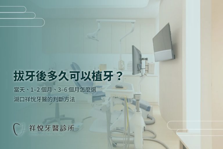 拔牙後多久可以植牙?三種時機,評估那一次就會告訴你