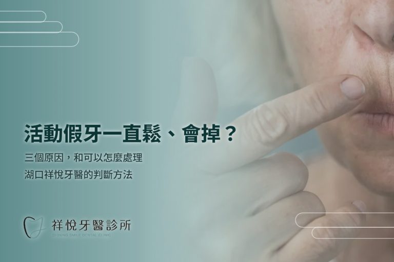 活動假牙一直鬆、吃飯會掉？三個原因與可以怎麼處理