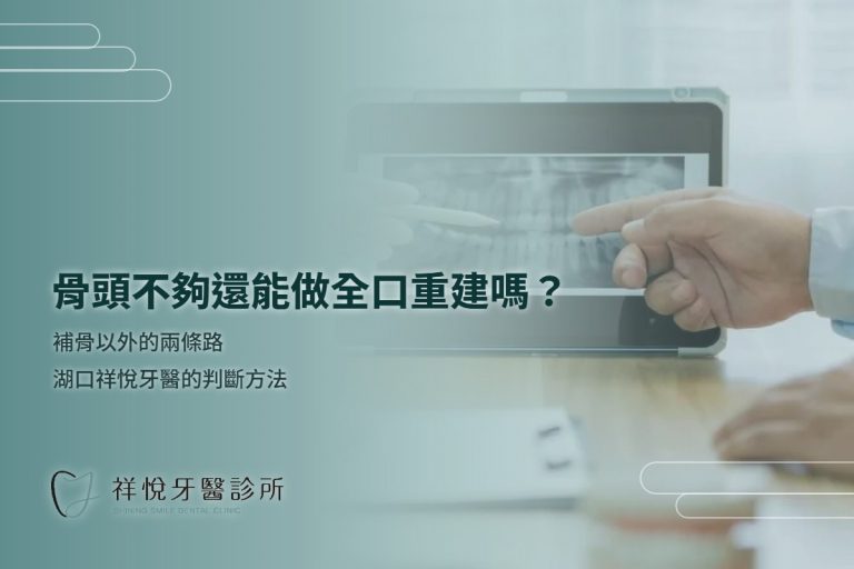 骨頭不夠還能做全口重建嗎？補骨以外的兩條路